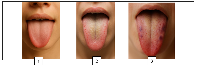 Dataset Tongue_MTCBC_Hope